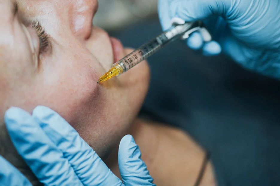 when does swelling lessen naturally after dermal fillers