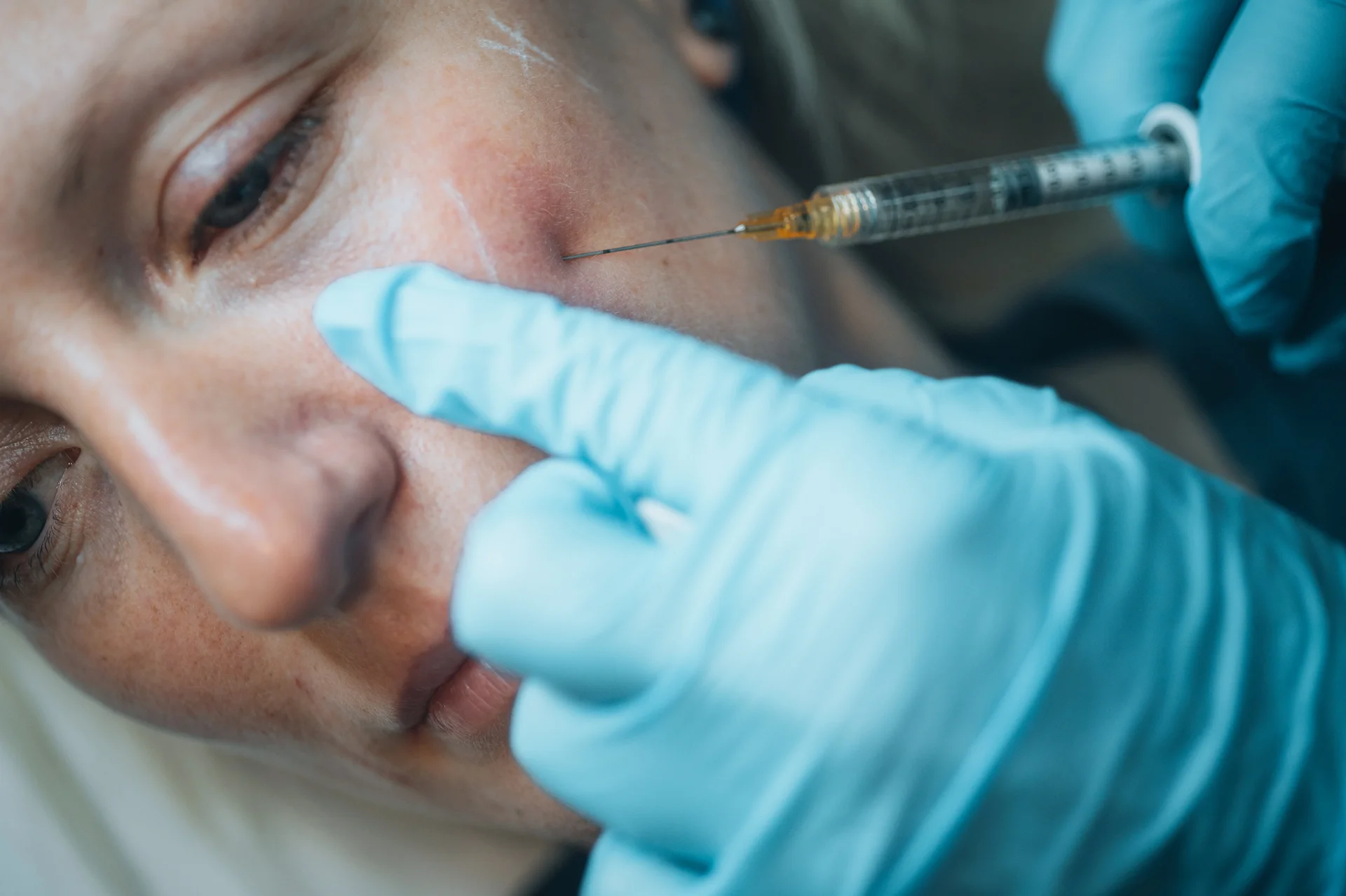a woman getting cheek filler treatment||