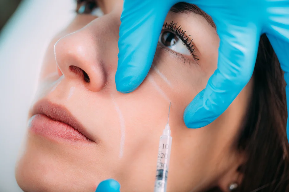 a woman get cheek filler injection