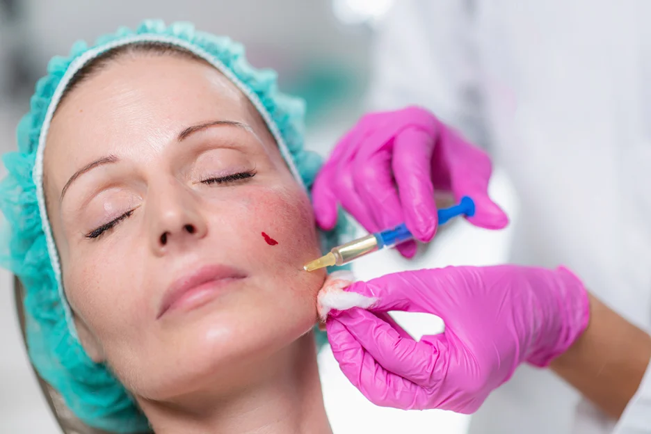 cheek filler treatment