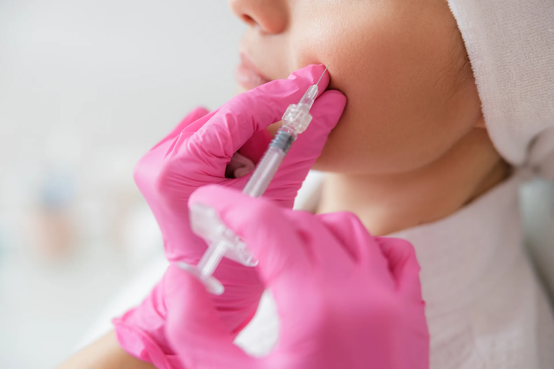 cheek filler treatment||