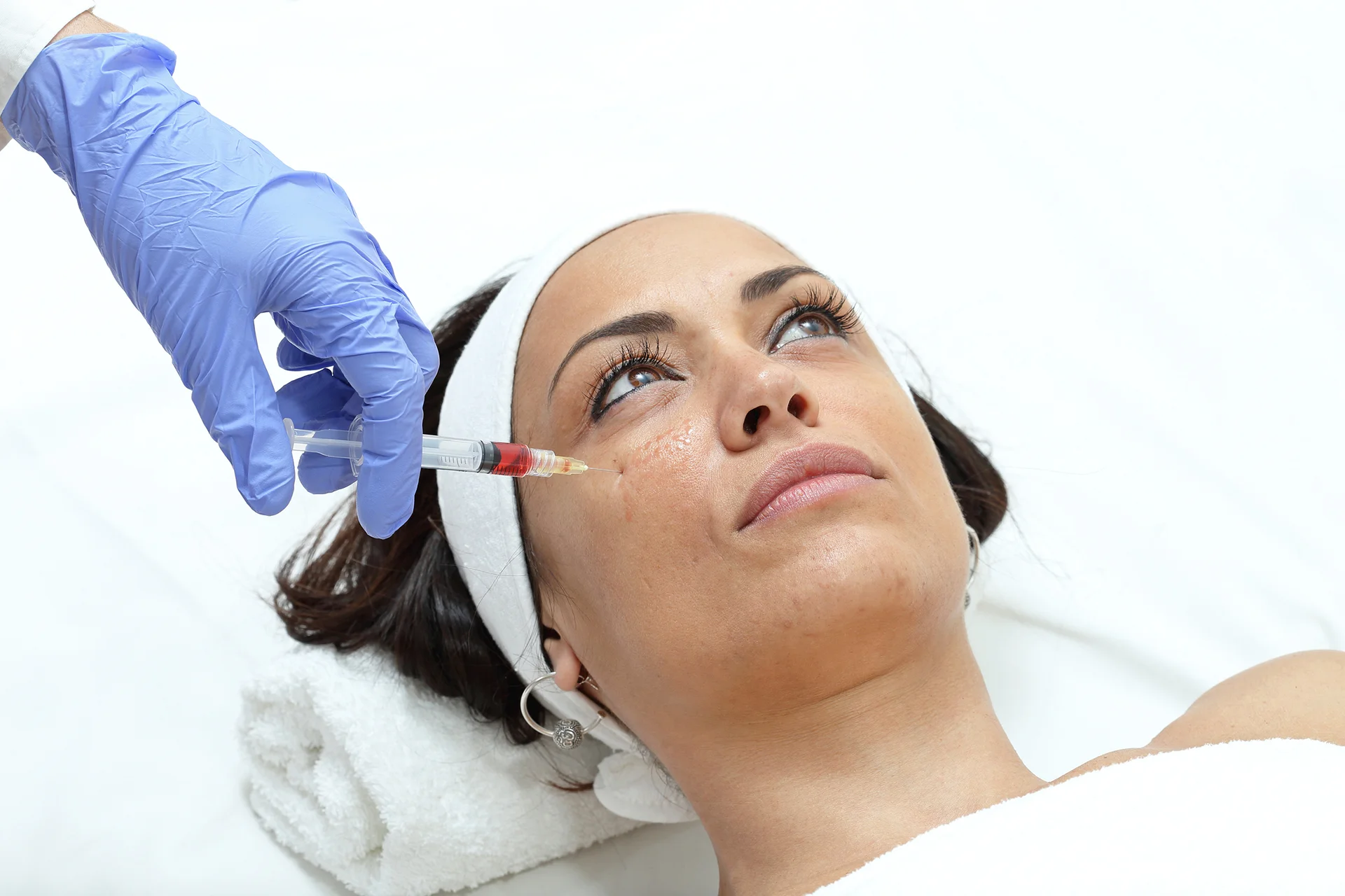 A woman getting cheek fillers||