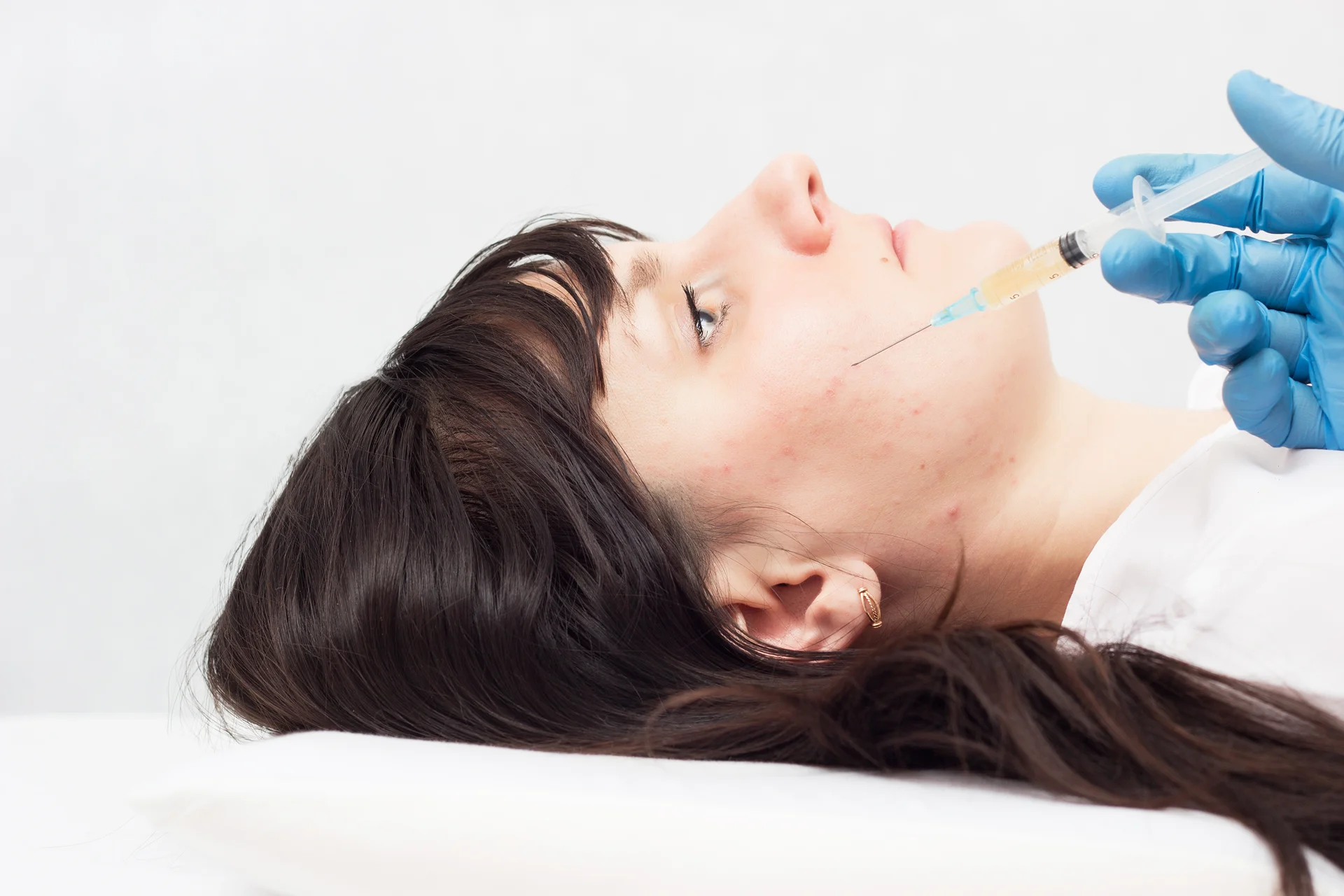A woman getting cheek fillers||