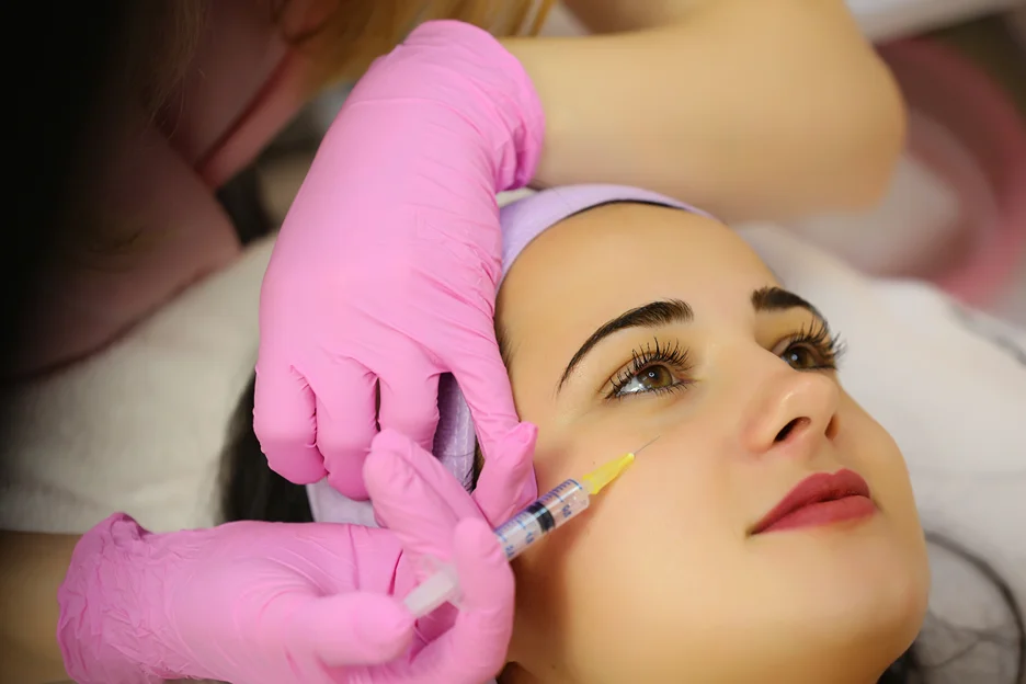 A woman having dermal fillers on cheeks