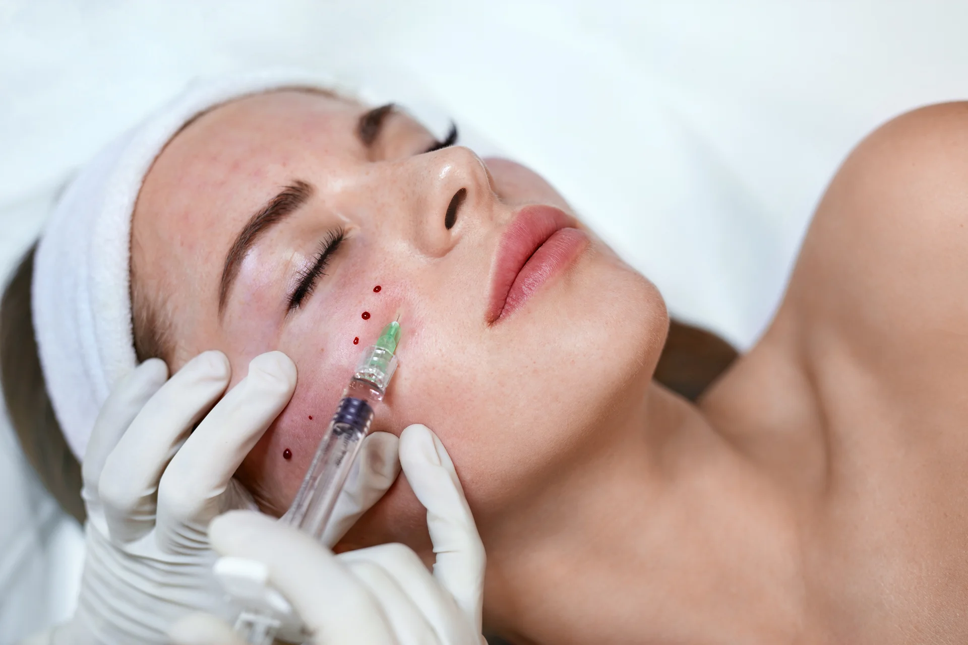 a woman getting cheek fillers||