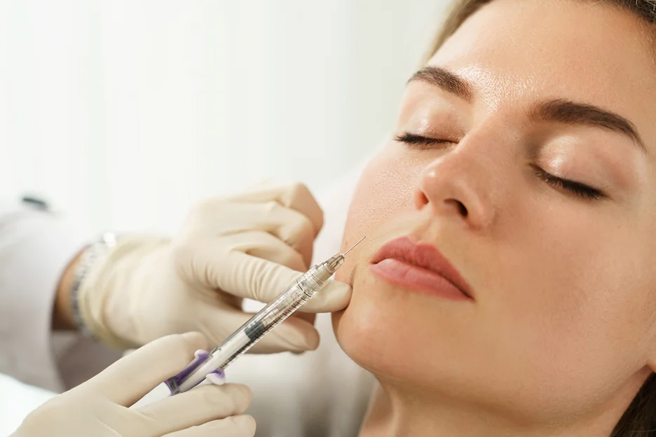 a woman received cheek filler injection on her nasolabial folds