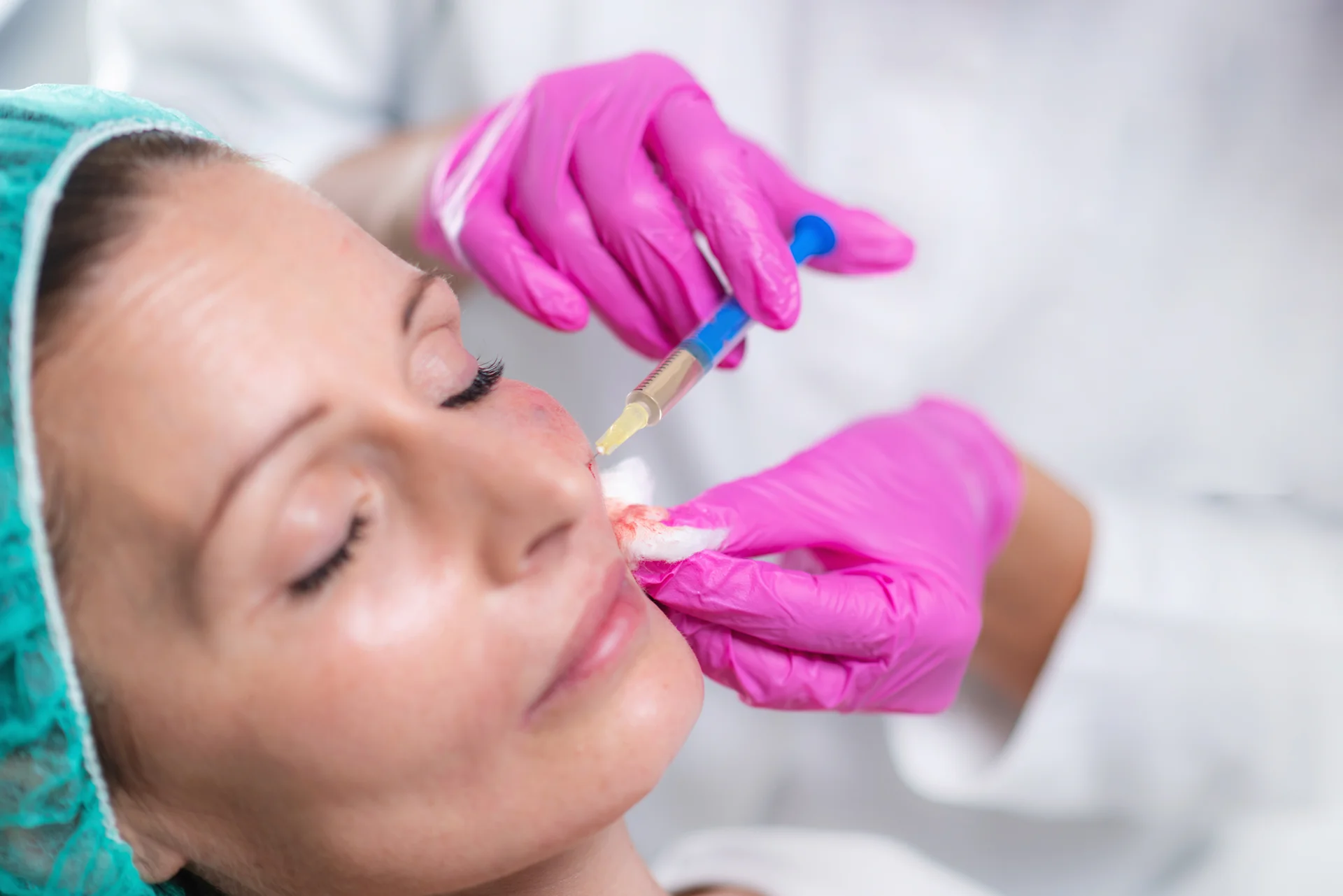 a woman having cheek filler||