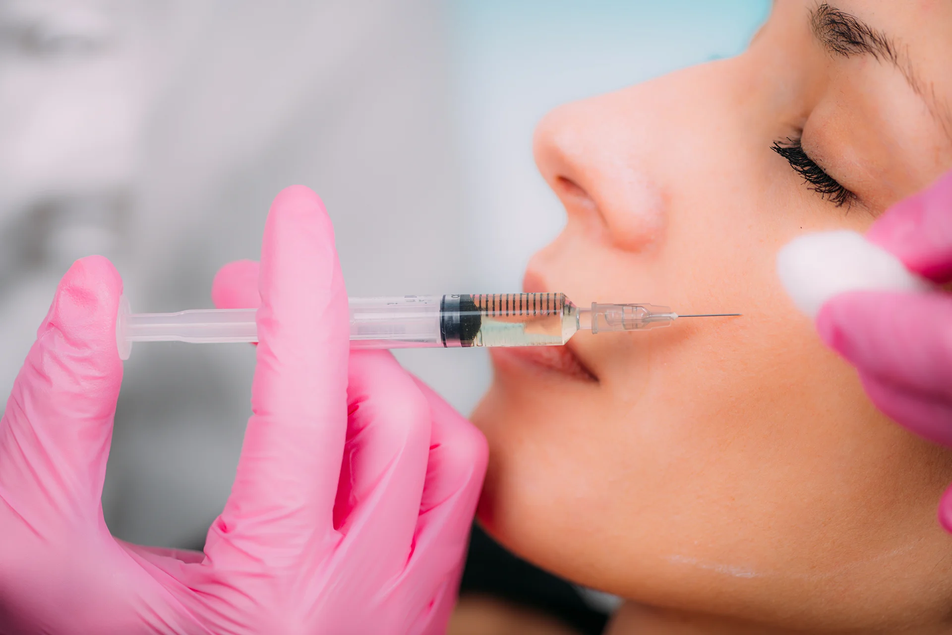 woman who had the type of cheek filler treatment that lasts longest|woman who undergo cheek filler procedure in Dr. Lanna's clinic