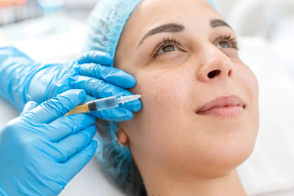 a woman had cheek filler treatment
