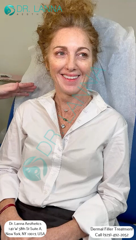 Smiling cheek filler client seated at Dr. Lanna Aesthetics in New York