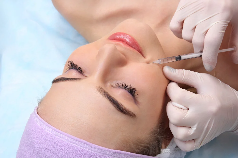 Cheek Fillers for Nasolabial Folds