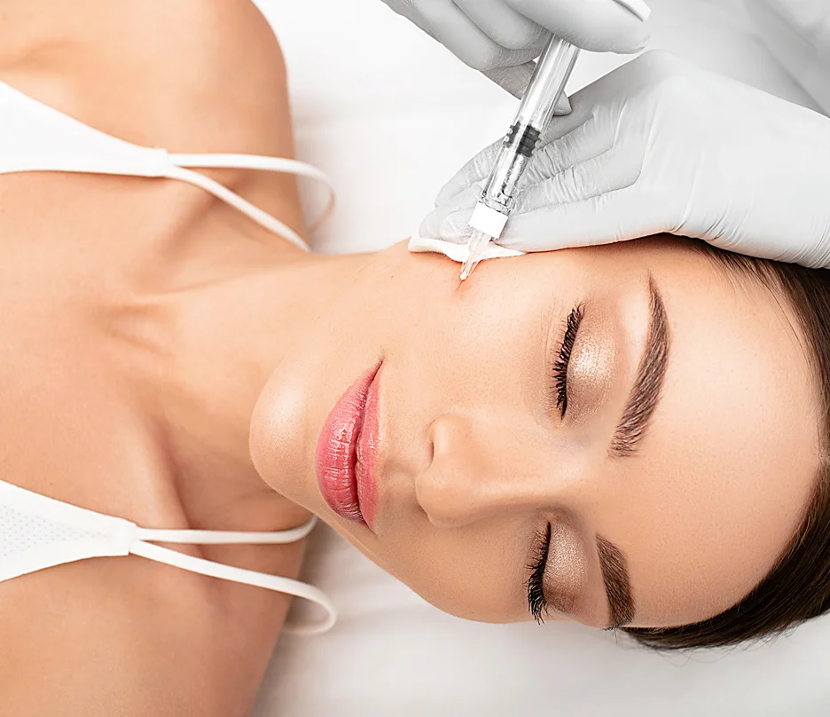 Cheek Fillers for Nasolabial Folds