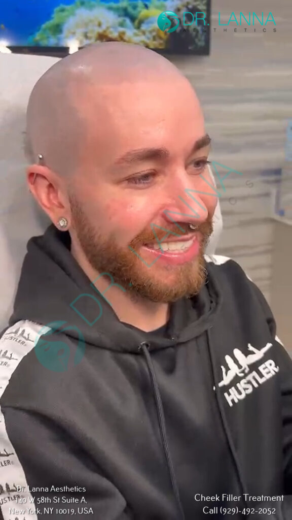 Smiling cheek filler client after treatment at Dr. Lanna Aesthetics, NYC