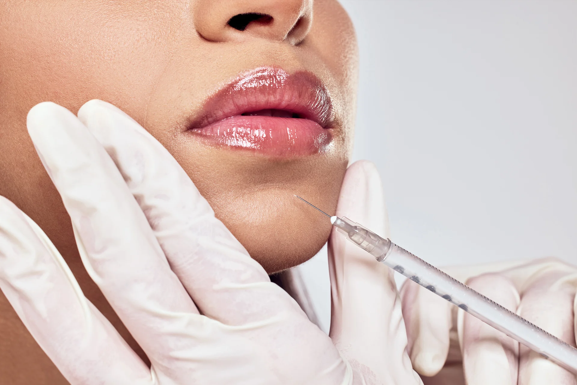 how long swelling last after the woman's chin filler treatment|swelling last after the woman's chin filler treatment
