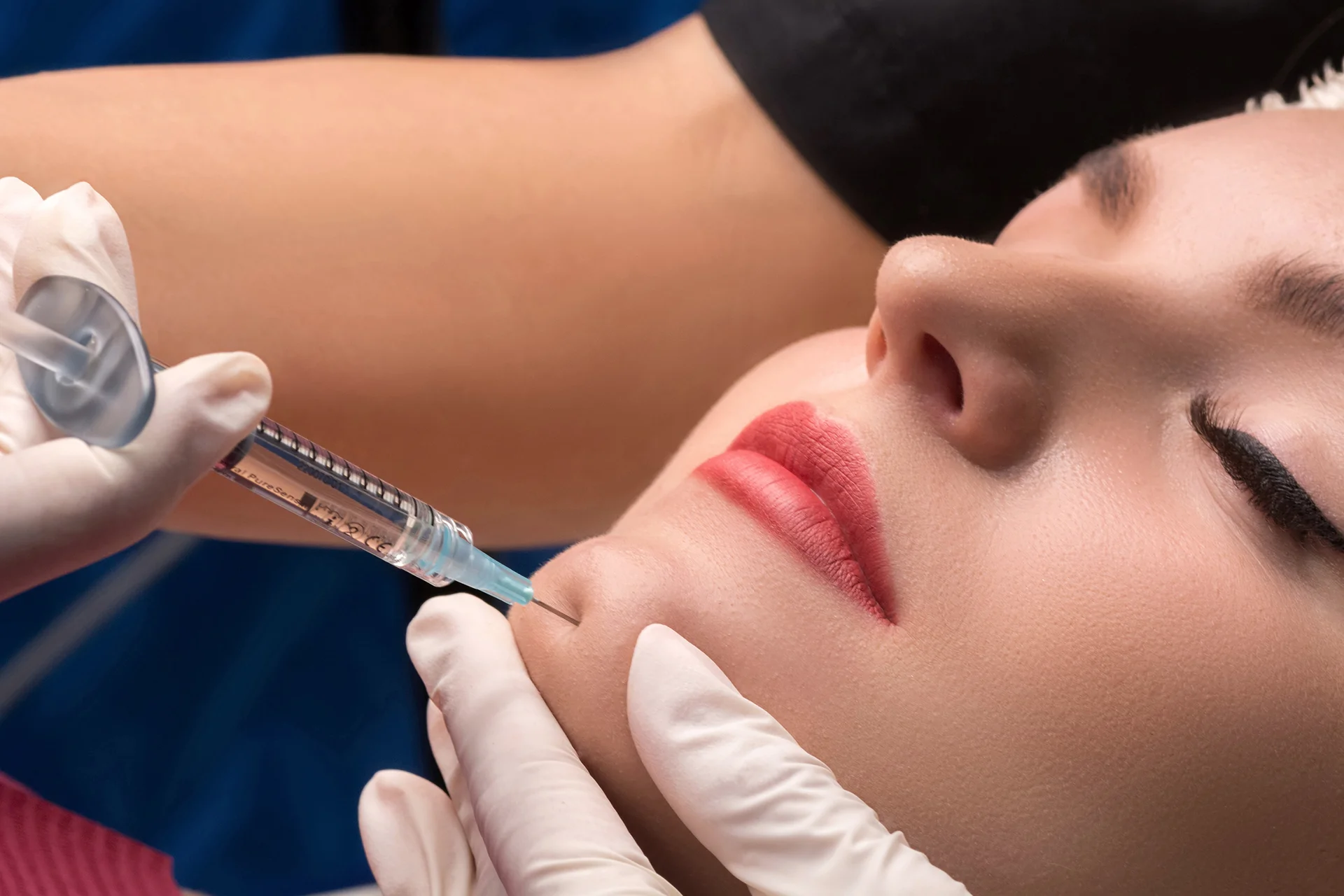 woman undergo chin fillers treatment|woman who had chin fillers