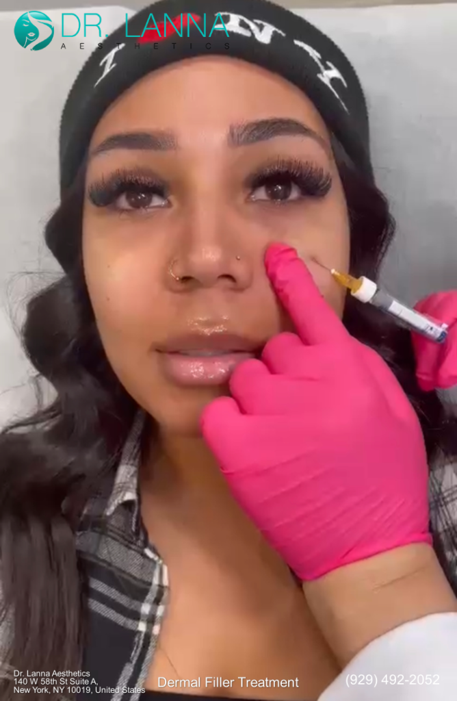 a portrait of a woman get dermal fillers treatment at Dr. Lanna Aesthetics' beauty clinic