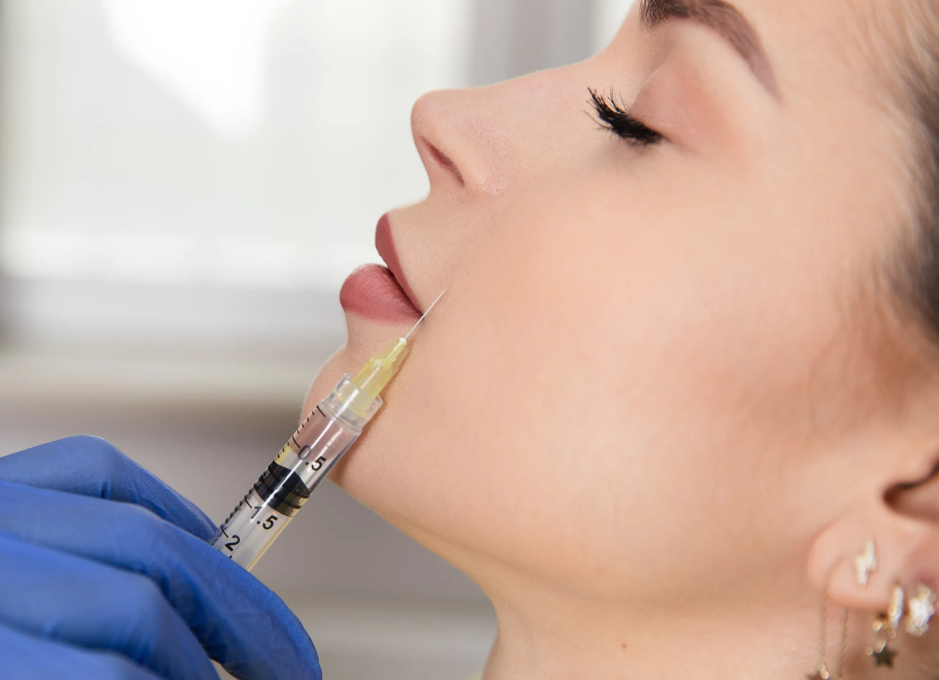 aesthetician injects demal filler on the nasolabial area|