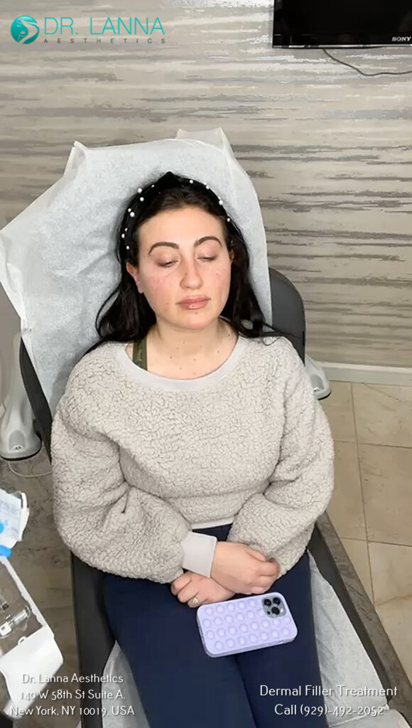 a woman had dermal filler procedure done at Dr. Lanna's clinic