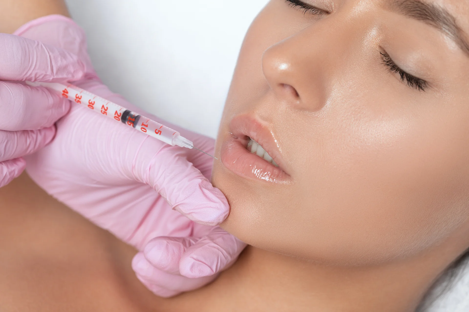 a woman had dermal filler treatment on her chin||