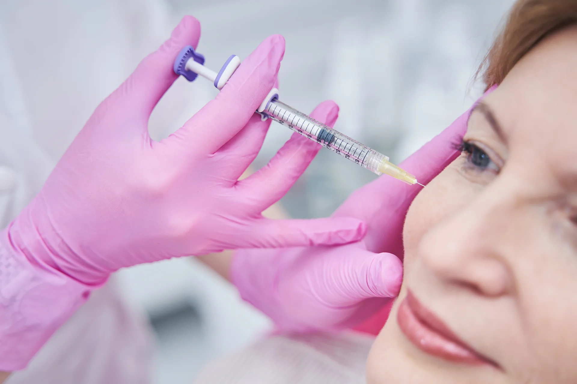 how long does it take for dermal fillers to settle|common side effects of dermal fillers|a woman had dermal filler injections at Dr. Lanna Aesthetics' beauty clinic