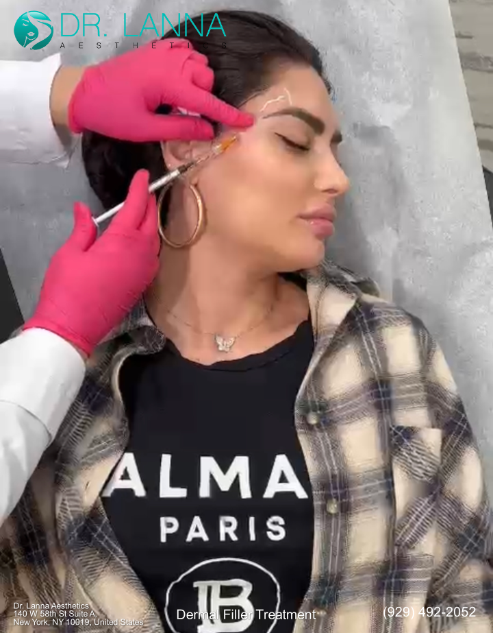 a woman receives dermal filler injetion from Dr. Lanna