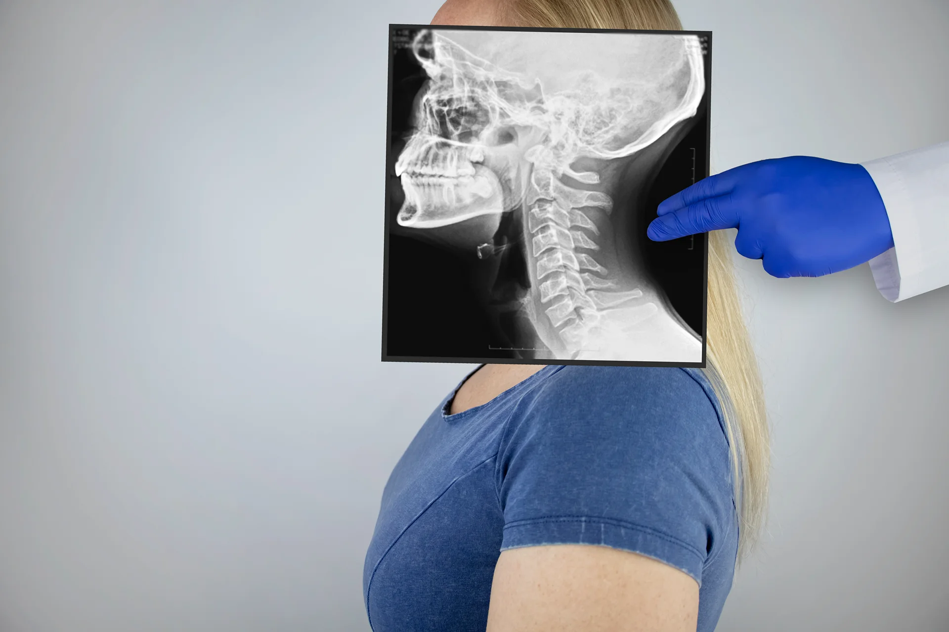 dermal fillers on x-rays|a man gets dermal filler injection|woman had lip filler procedure at Dr. Lanna Aesthetics' beauty clinic
