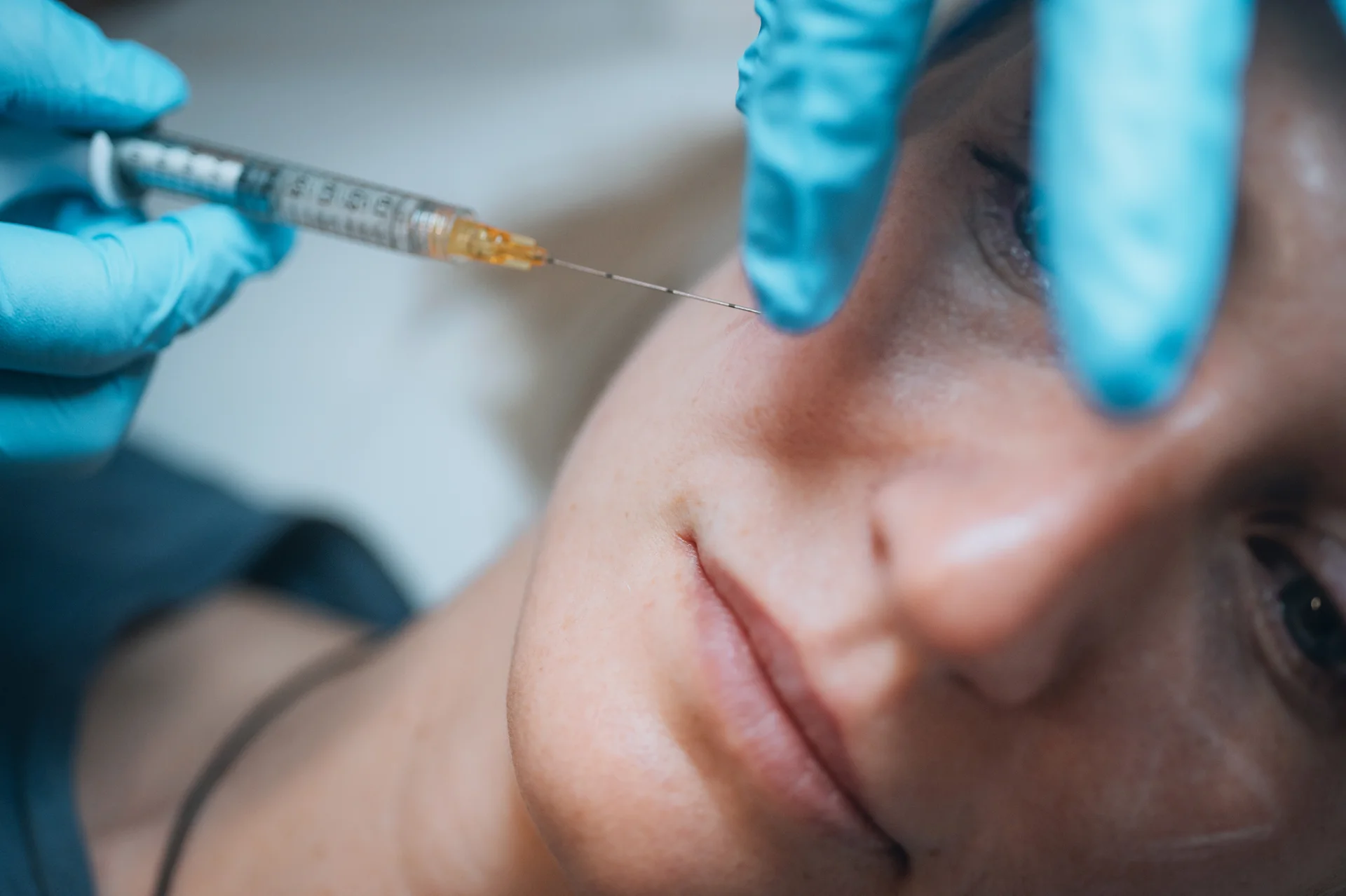A Woman Getting Cheek Filler||