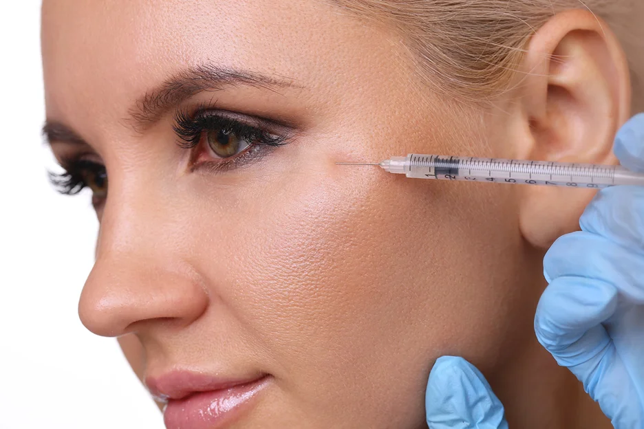 cheek filler treatment