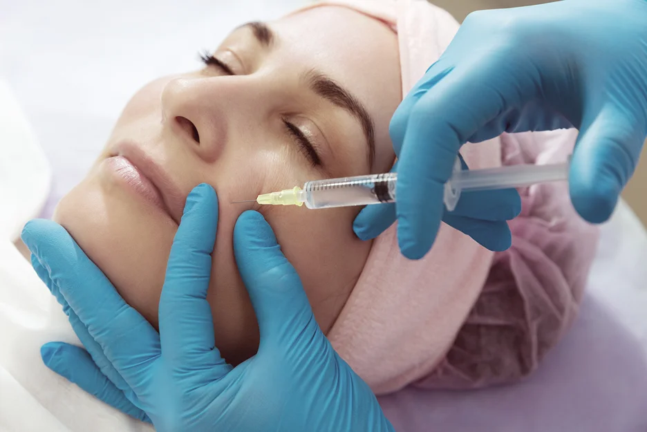 cheek filler treatment