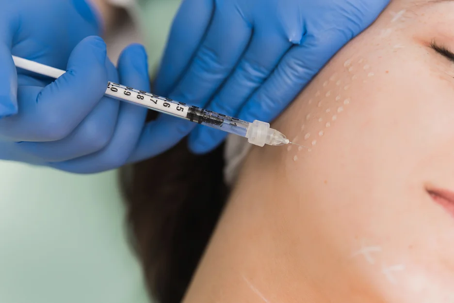 how dermal fillers can change the jawline before and after