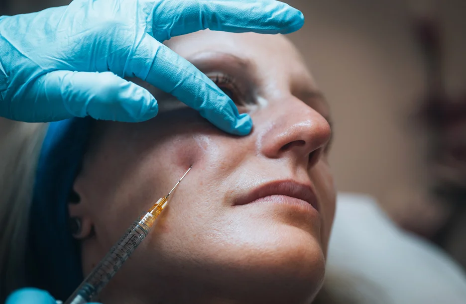 how good are restylane cheek fillers