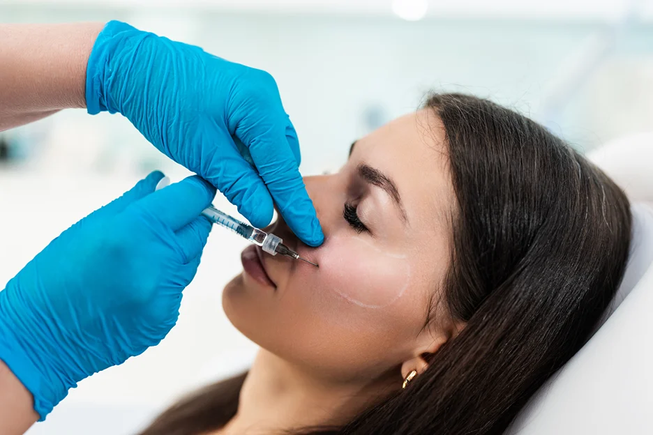 Gloved practitioner injecting filler into a woman's cheek with marked guidelines