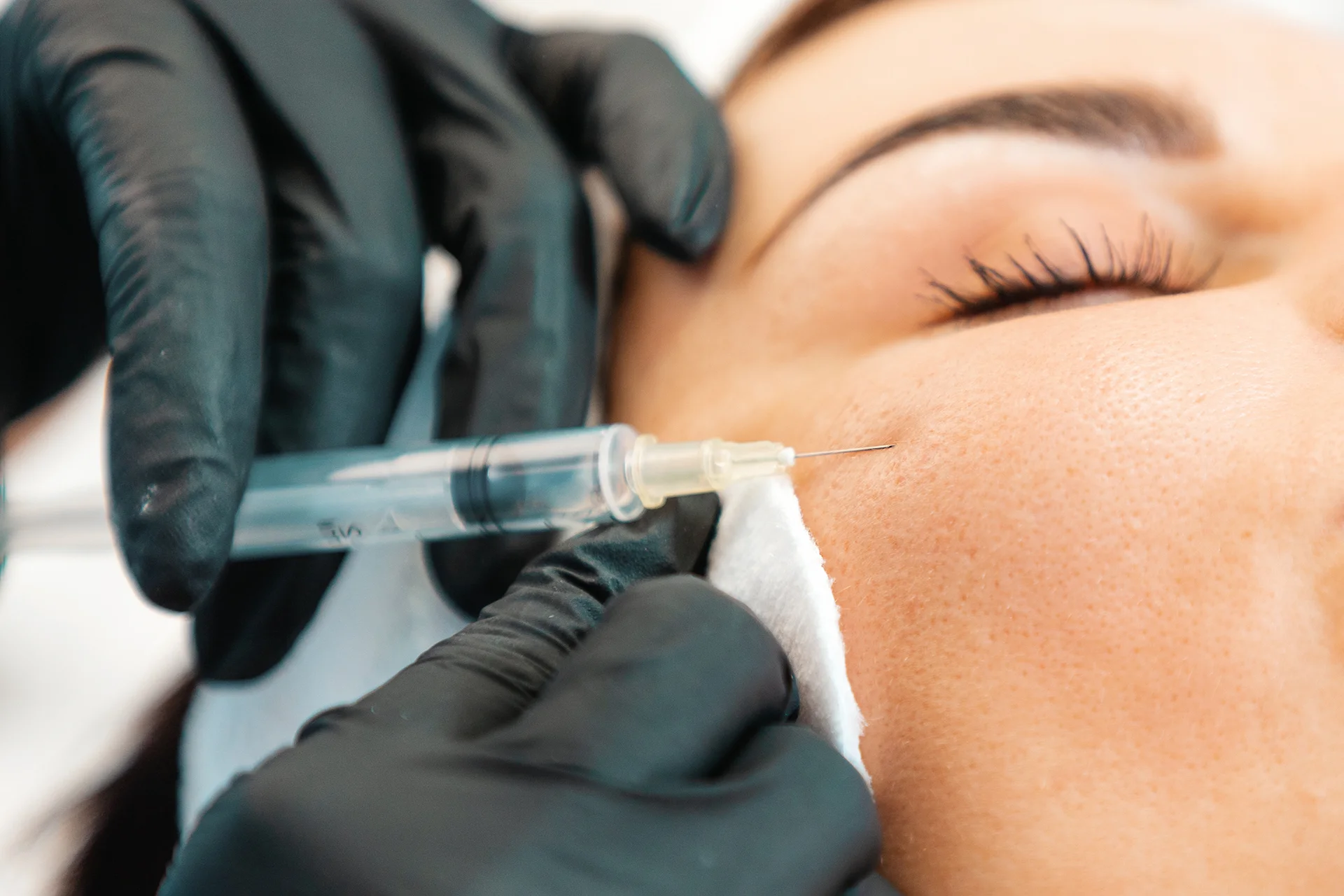 cheek filler treatment||
