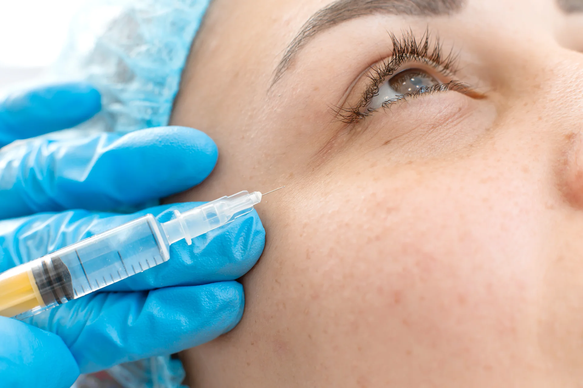 A Woman Getting Cheek Filler Treatment||