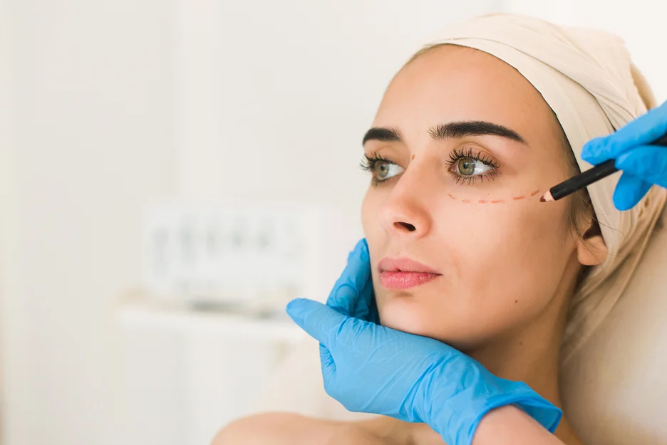 medical provider marks the patient's cheek to place for the filler injections