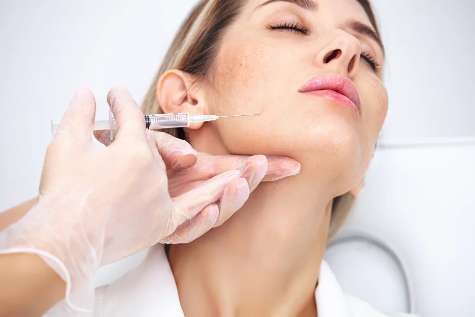 cheek filler treatment