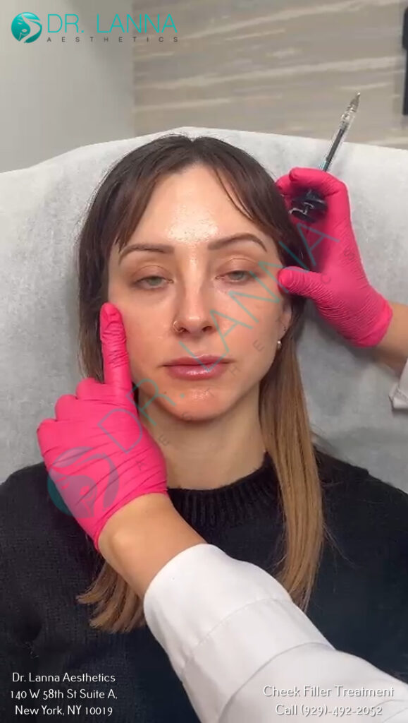 a woman getting cheek filler treatment