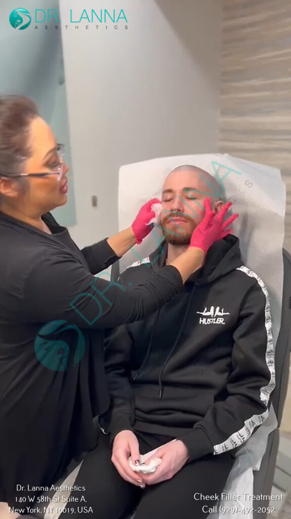 Cheek Filler Treatment at Dr. Lanna Aesthetics