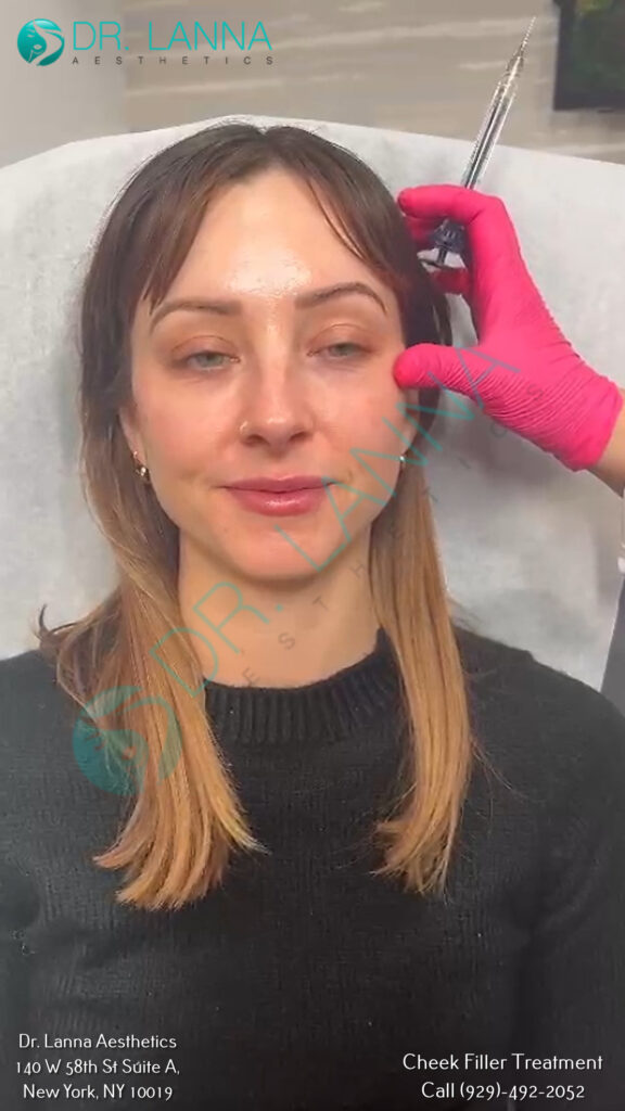 a woman having cheek fillers
