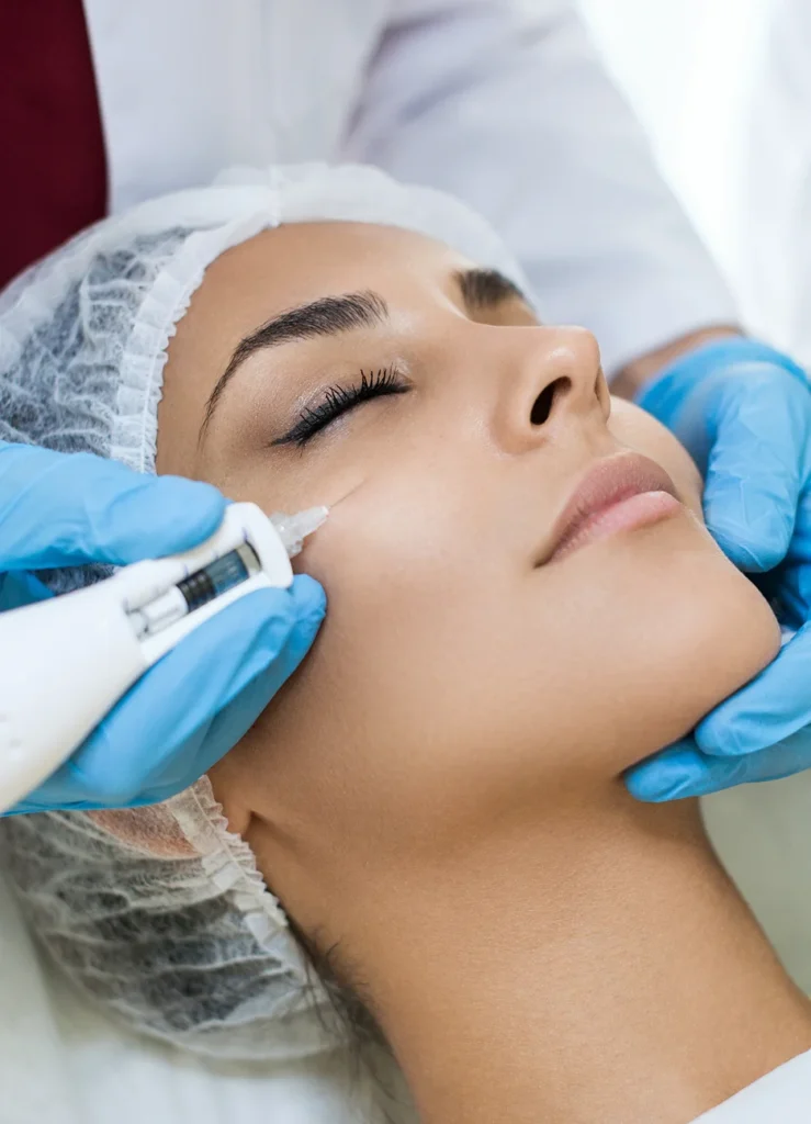 Submalar Cheek Filler Treatment