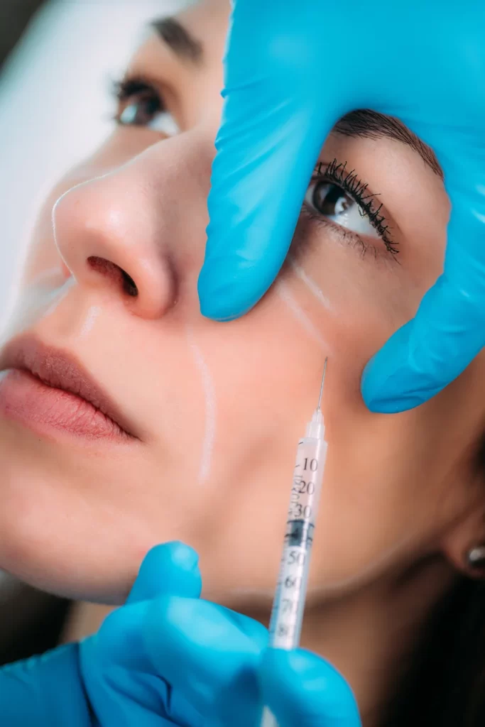 a woman getting cheek fillers