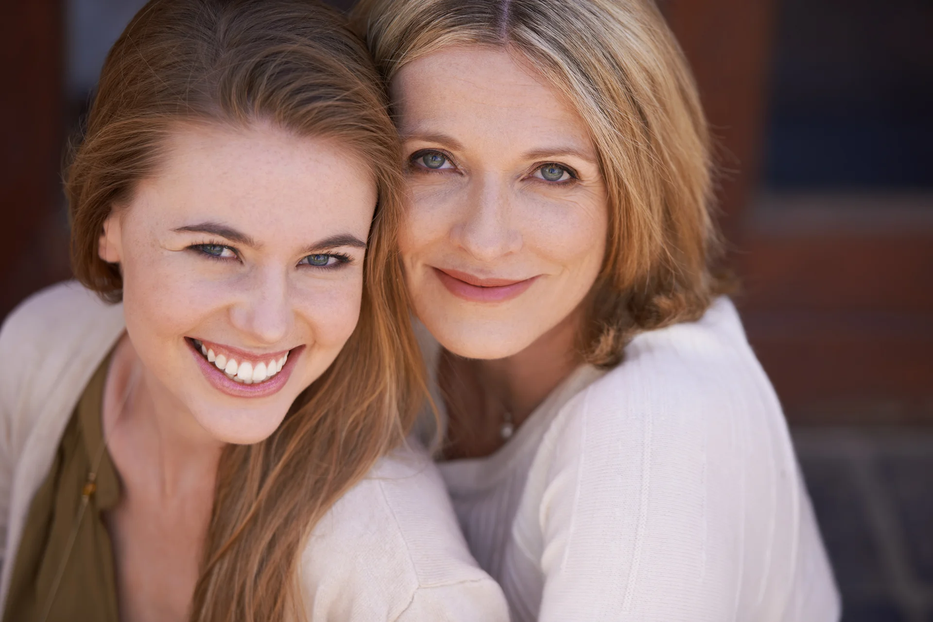 young woman and middle aged woman ideal for cheek filler treatments|young woman received cheek filler treatment