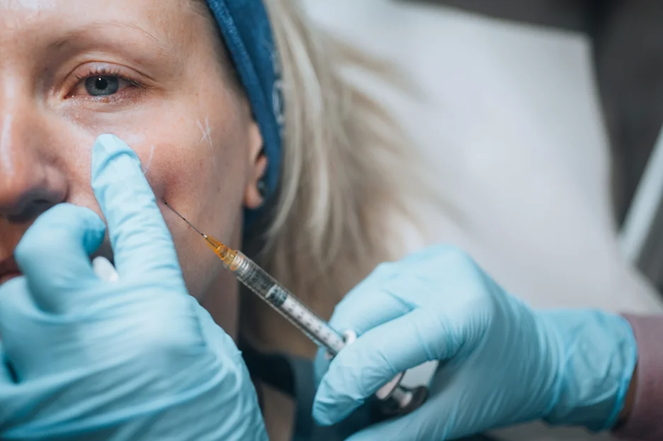 A Woman Getting Cheek Filler Treatment