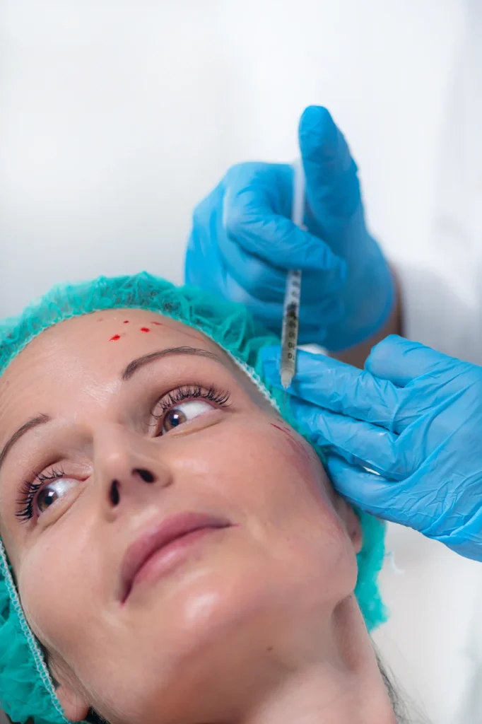 A Woman Getting Cheek Filler Treatment