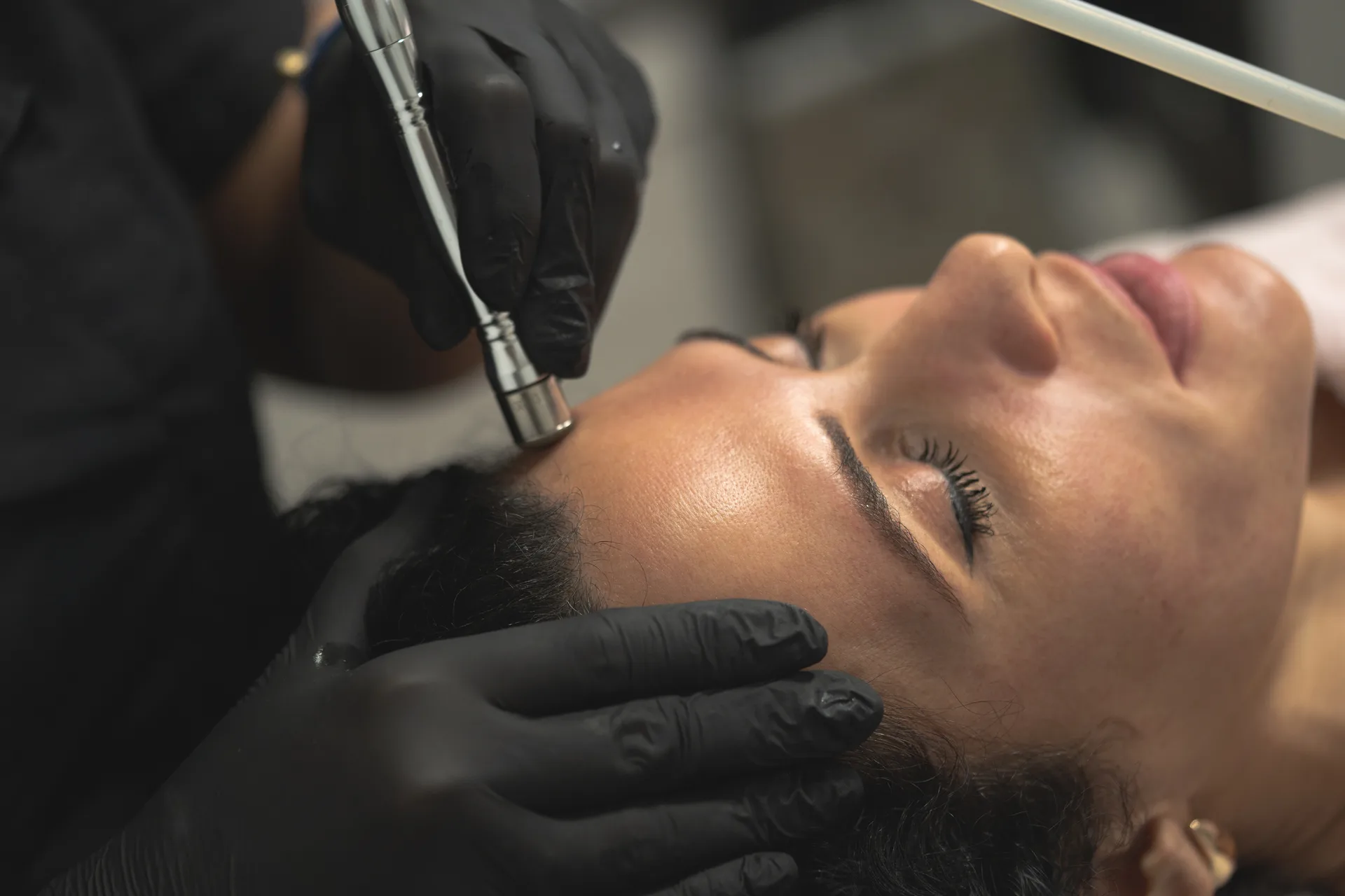 Hydradermabrasion Facial technique