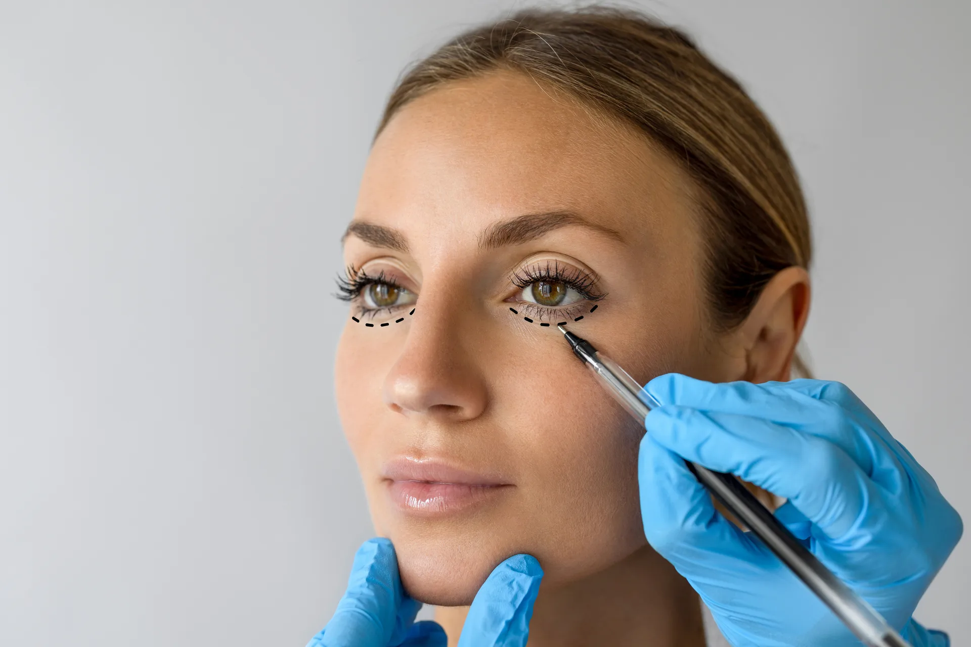 Facial Plastic Surgery technique