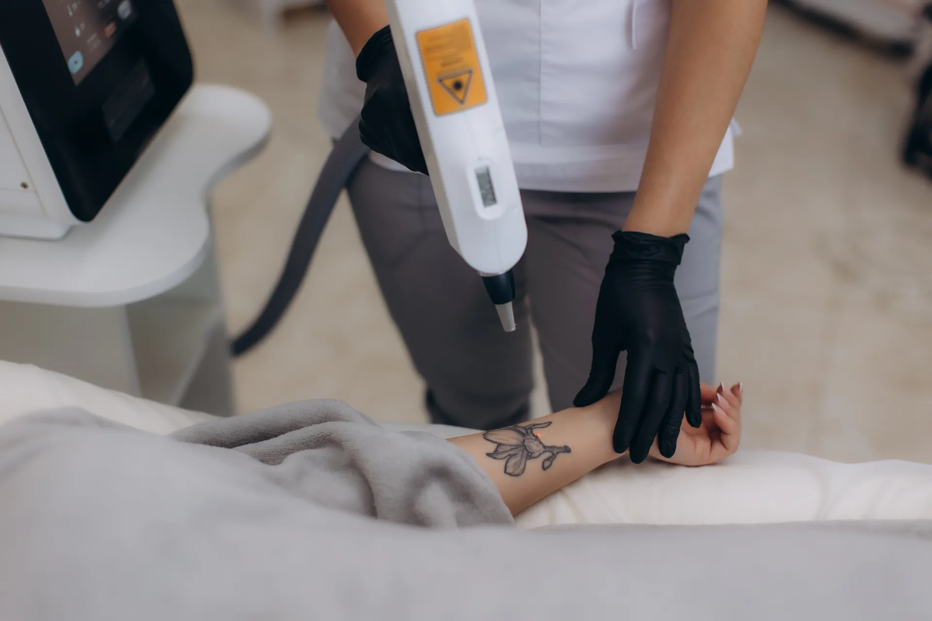 Tattoo Removal in NYC