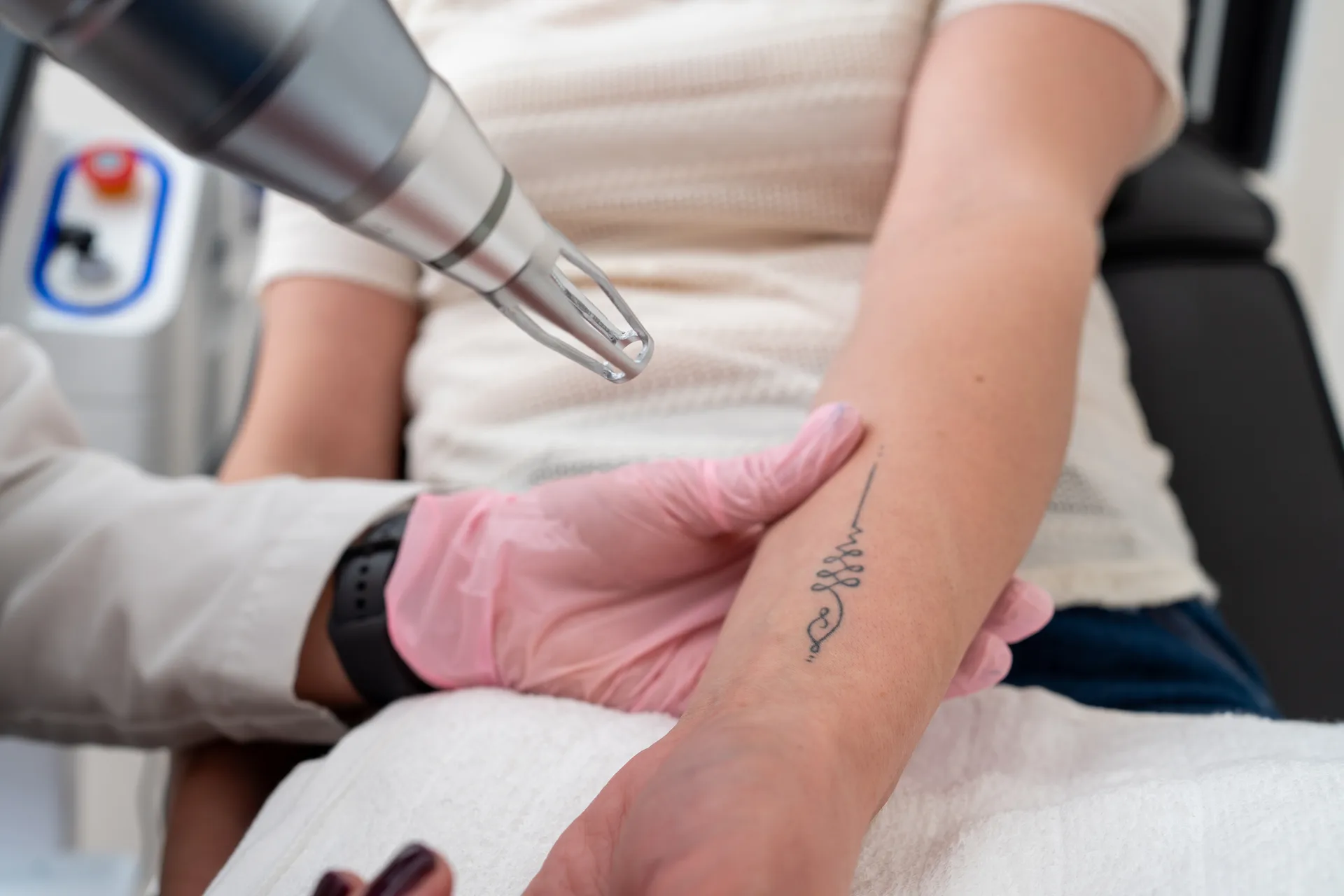 Laser Tattoo Removal technique