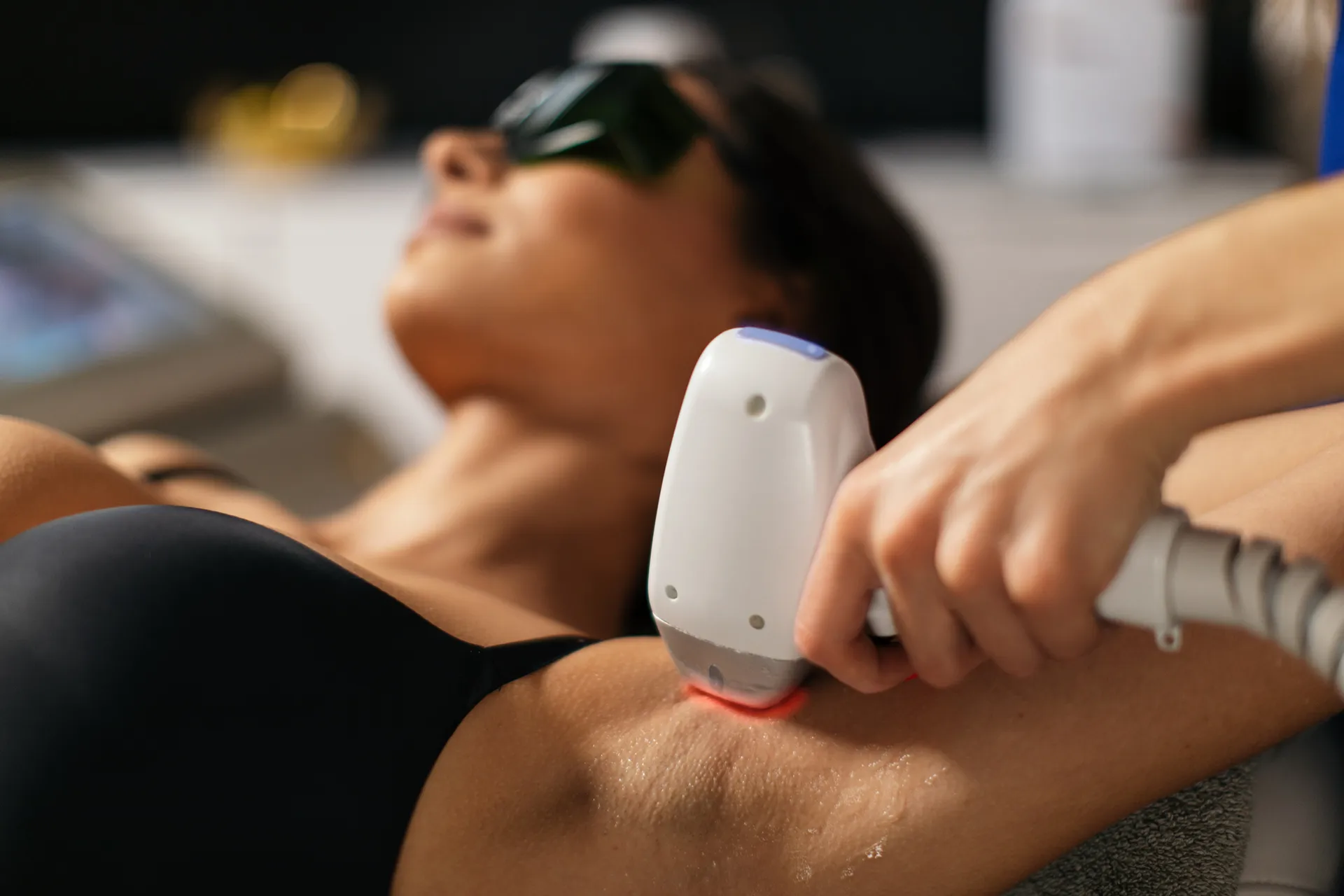 Laser Hair Removal technique