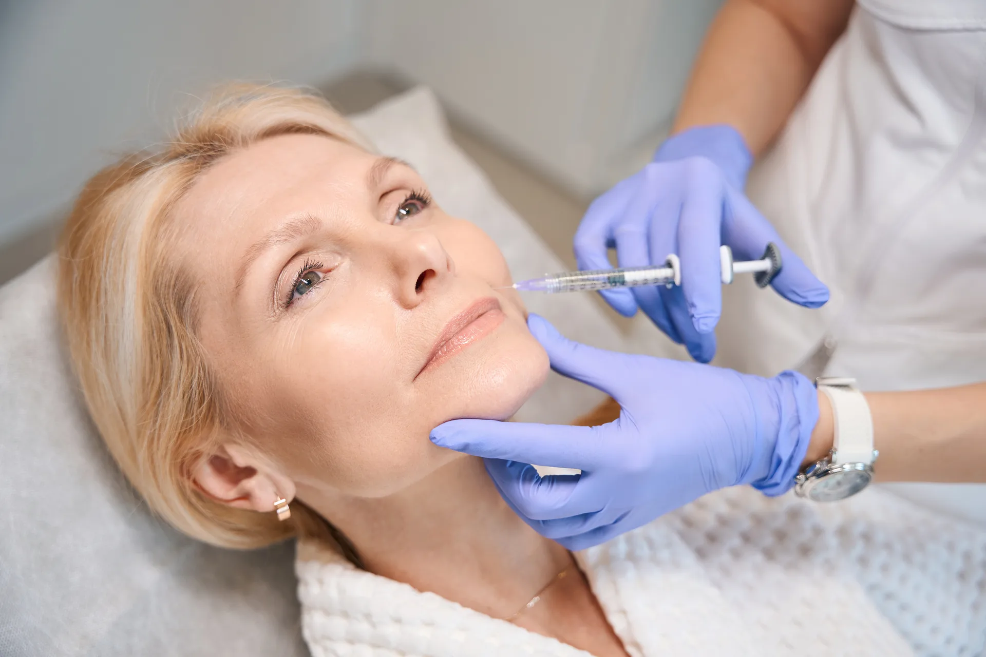 Radiesse filler treatment